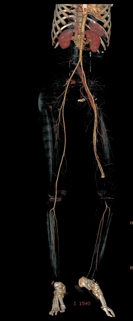 صورة اشعاعية تظهر الجزء المصاب